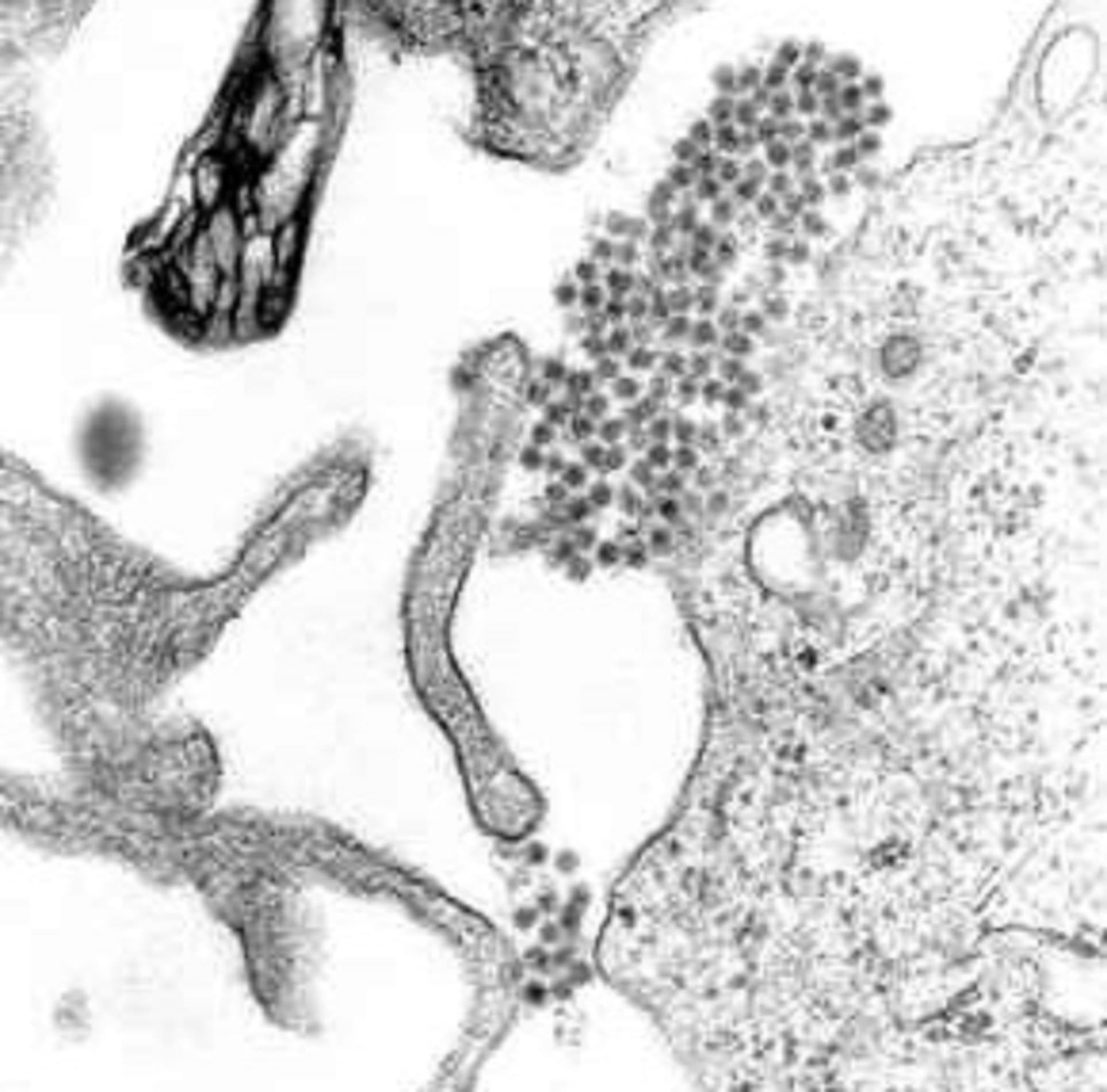 Due casi di virus Dengue a Udine e Livorno, al via la disinfestazione